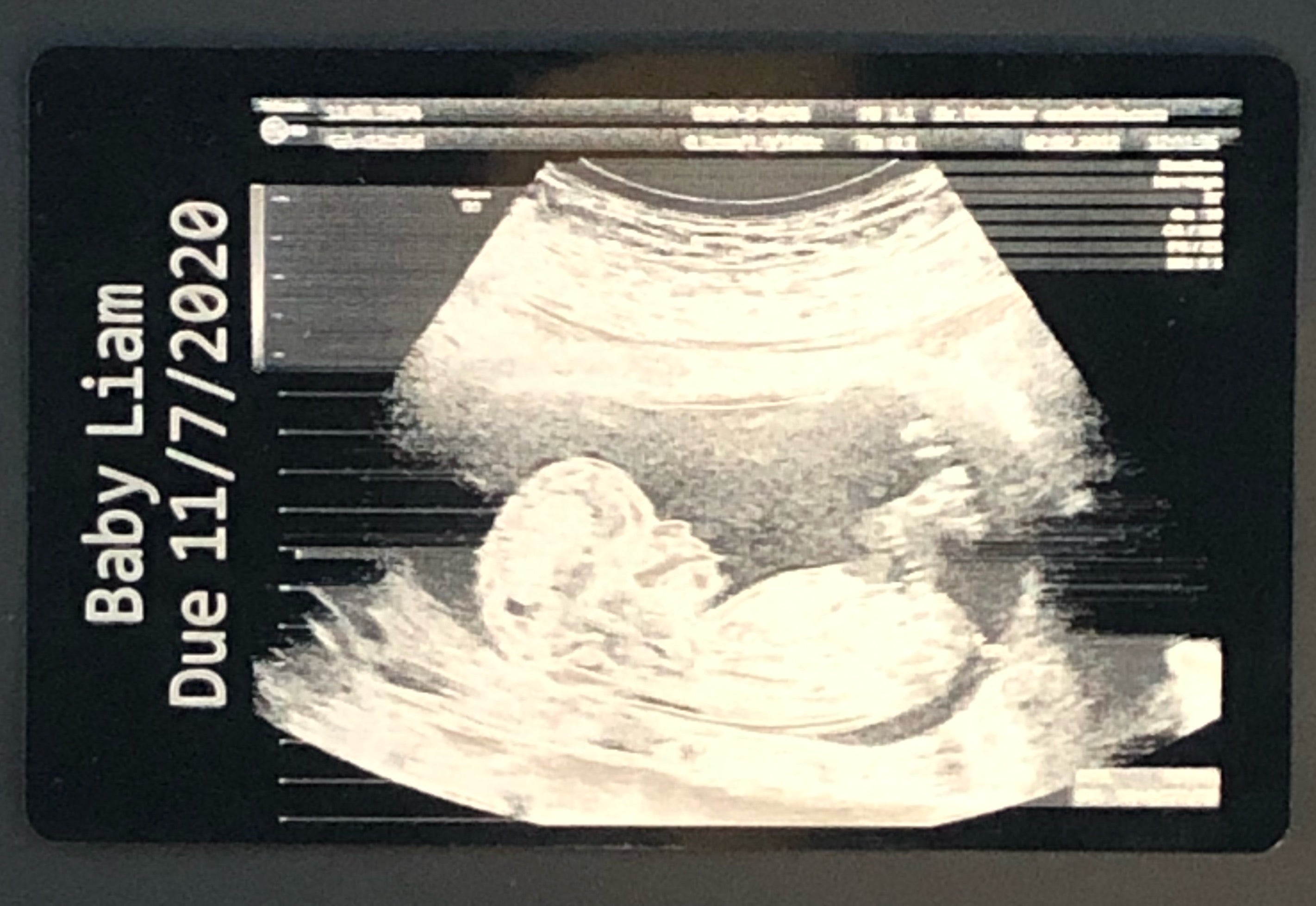 Ultrasound Keepsake Photo