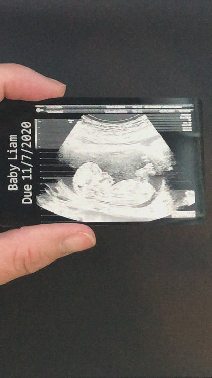 Ultrasound Keepsake Photo